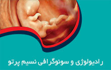 رادیولوژی خانم